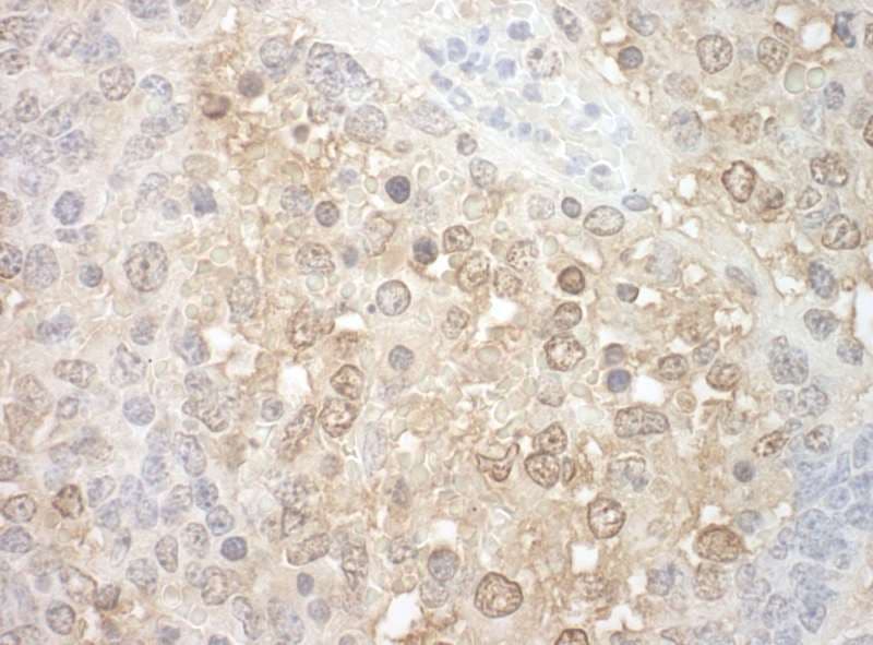 TFIP11 Antibody (aa1-50)