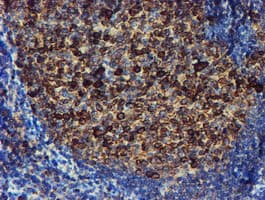PDIA4 / ERP72 Antibody (clone OTI2C11)