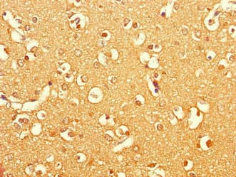 BRINP1 / DBC1 Antibody