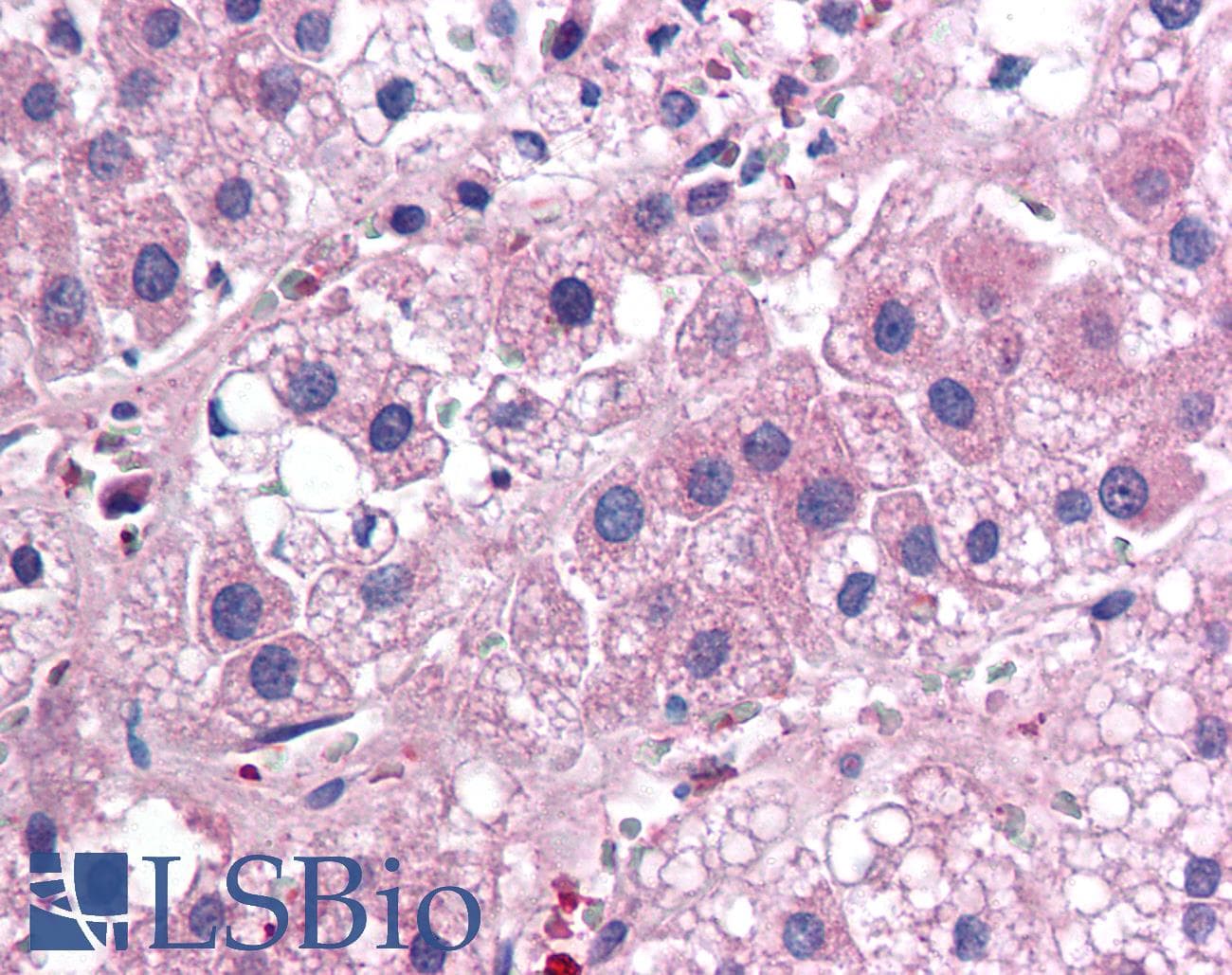 IHC-plus™ Monoclonal Mouse anti-Human IL25 / IL17E Antibody (clone 68C1039.2, aa115-132, IHC, WB)