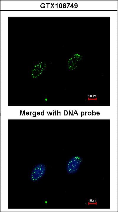 Polyclonal Rabbit anti-Human RPA70 / RPA1 Antibody (aa369-616, IHC, WB)