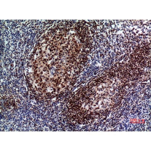 Polyclonal Rabbit anti-Human PAX5 Antibody (161-210 aa, Internal, IHC, WB)
