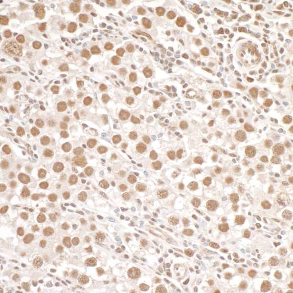 Polyclonal Rabbit anti-Human SMC1A / SMC1 Antibody (phospho-Ser966, IHC, IF, WB)
