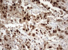 MKI67 / Ki67 Antibody (aa1160-1493, clone OTI5E6)