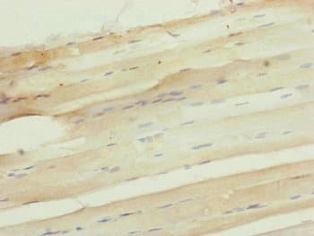 CDCA1 / NUF2 Antibody