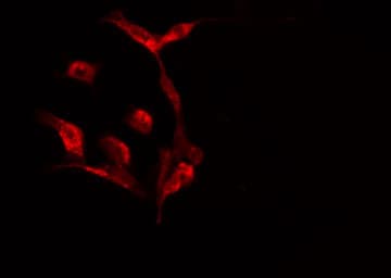 Polyclonal Rabbit anti-Human SEPT7 / Septin 7 Antibody (IF, WB)