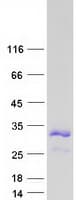 Human SBSN Protein (Recombinant Myc-DDK (Flag))