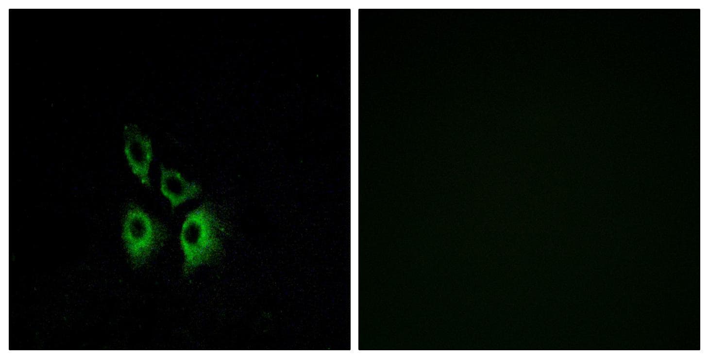 Polyclonal Rabbit anti-Human ADRA1A Antibody (IF, WB)