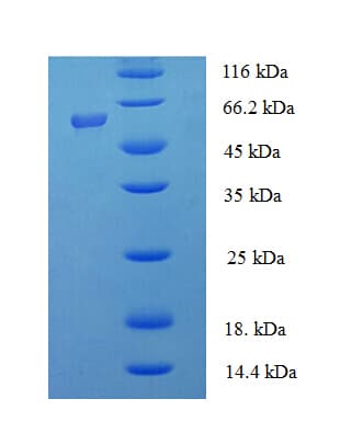 Human INPP5A Protein (Recombinant His-SUMO)