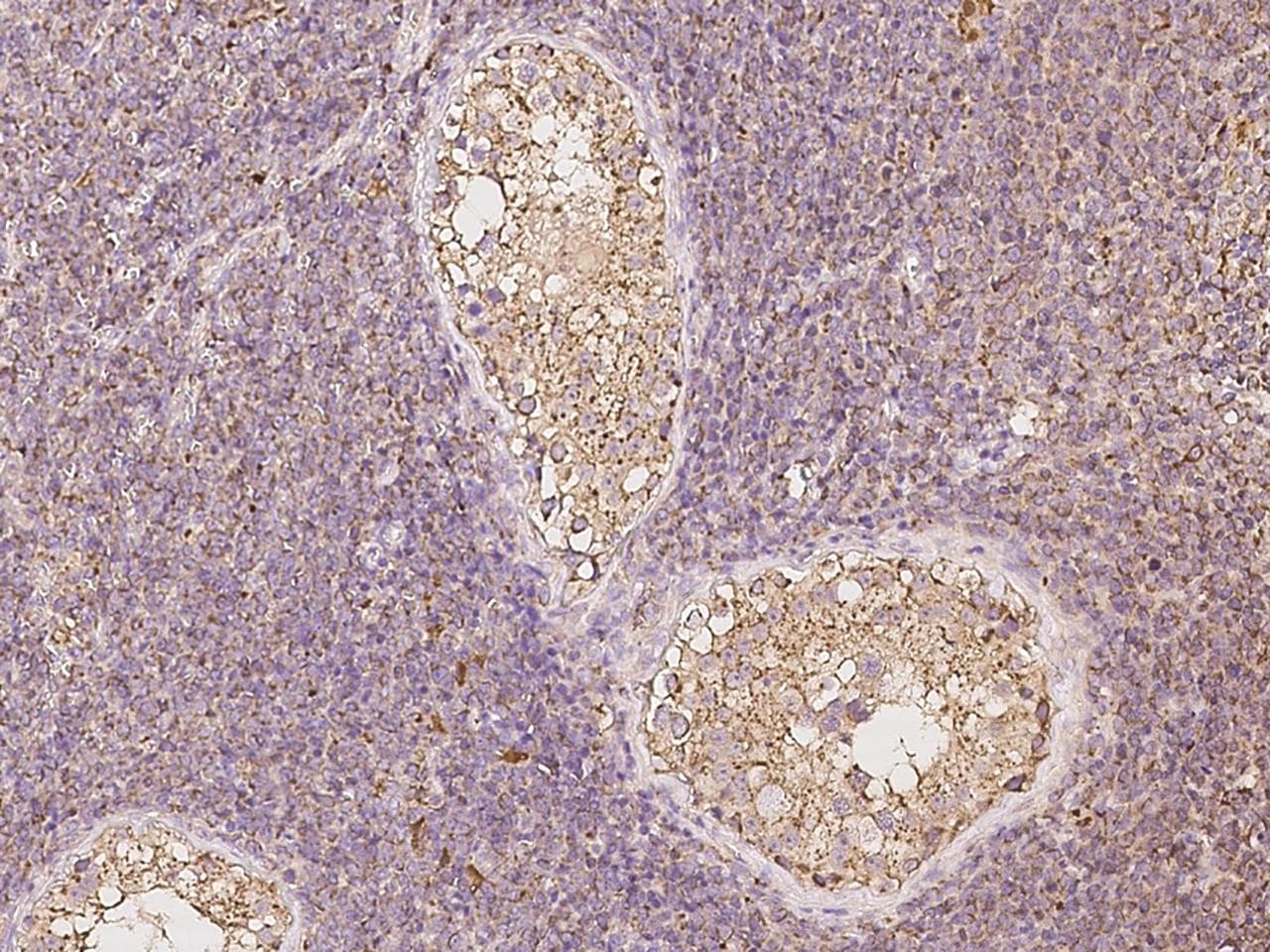 ULBP1 Antibody