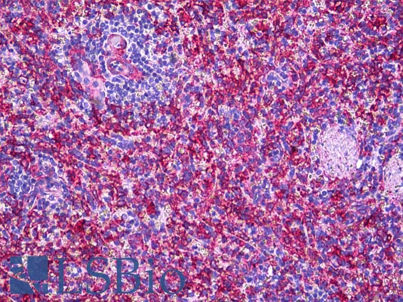 IHC-plus™ Polyclonal Rabbit anti-Human MMP11 Antibody (aa61-110, IHC, IF, WB)