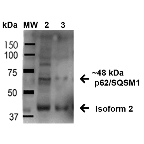 SQSTM1 Antibody (APC)