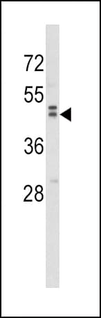 WNT10B Antibody (aa193-222)