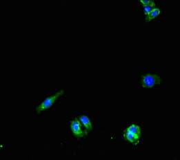 Polyclonal Rabbit anti-Human PNPLA1 Antibody