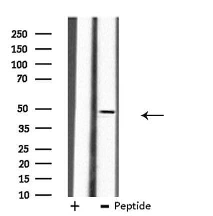 B4GALT3 Antibody