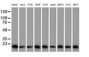 PFN1 / Profilin 1 Antibody (clone OTI2D2, Carrier-free)