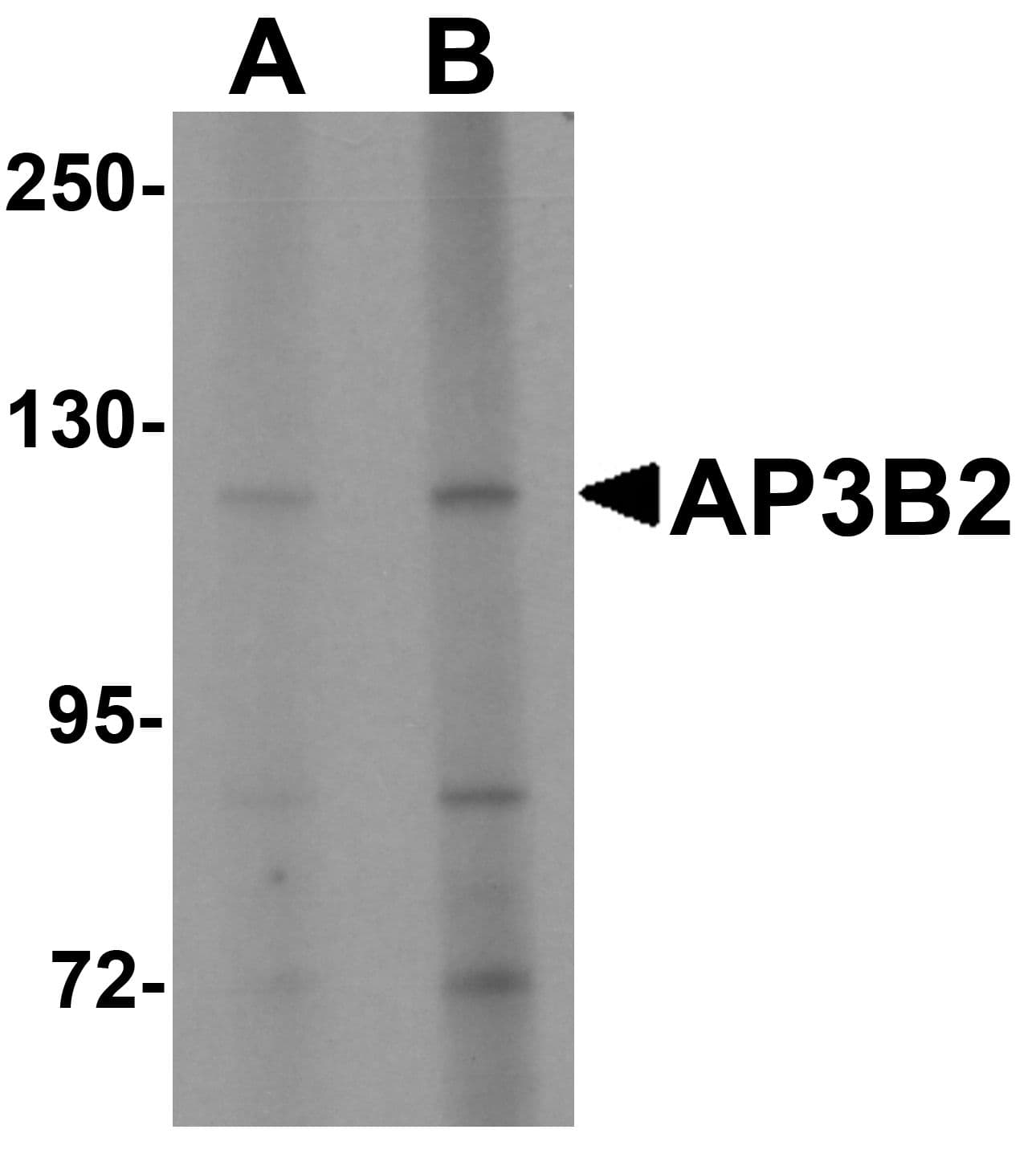 IHC-plus™ AP3B2 Antibody