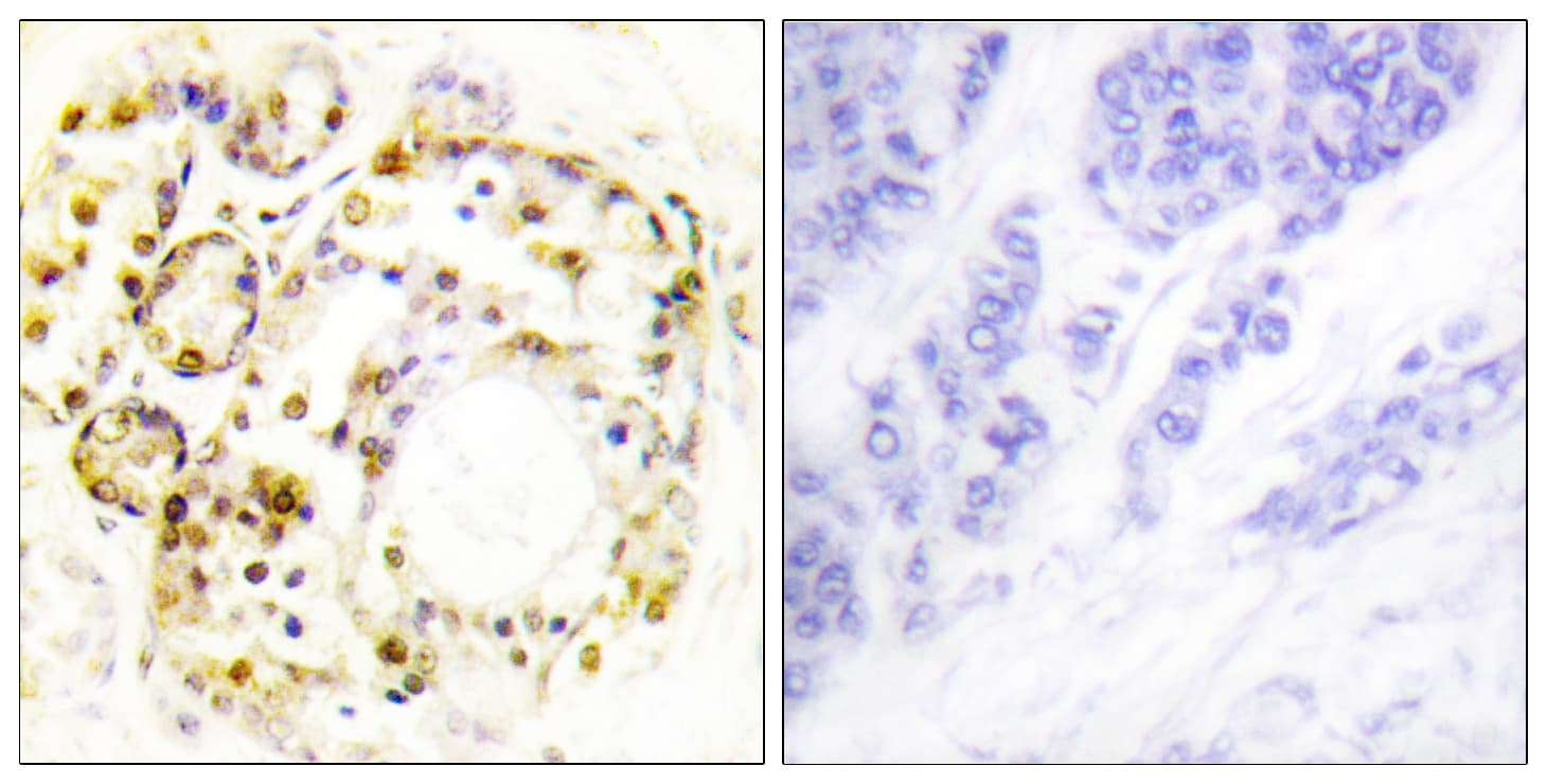 Polyclonal Rabbit anti-Human MAPK6 / ERK3 Antibody (phospho-Ser189, IHC, WB)