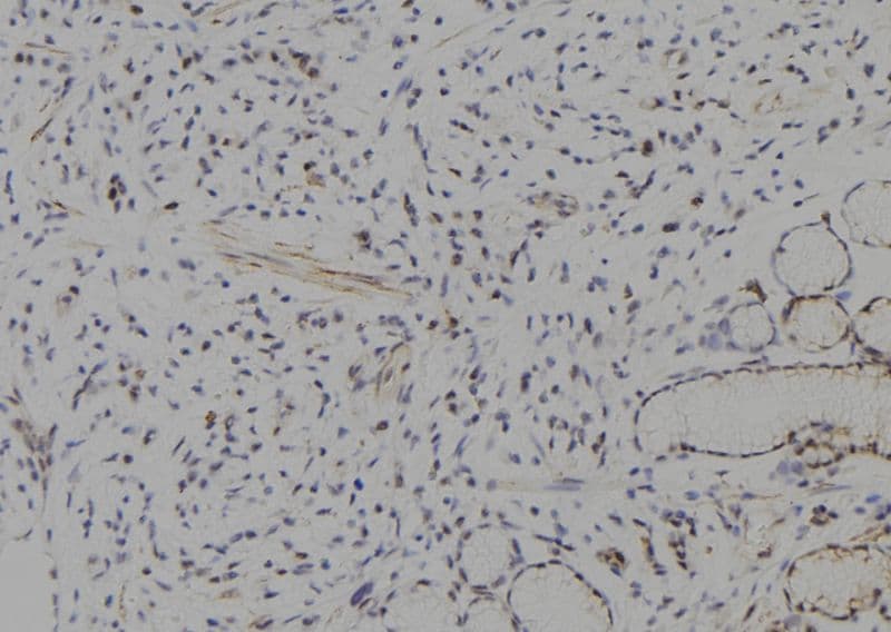 HES1 / HES-1 Antibody