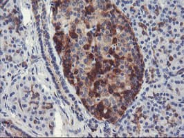 PFKP Antibody (clone OTI3H8)