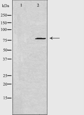 GLCNE / GNE Antibody
