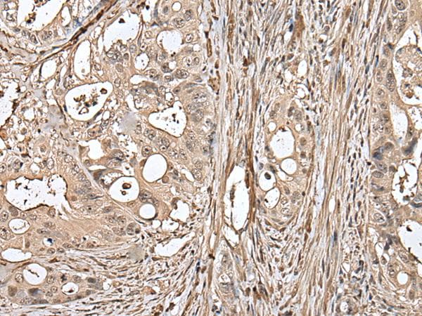 UTP3 / CRLZ1 Antibody