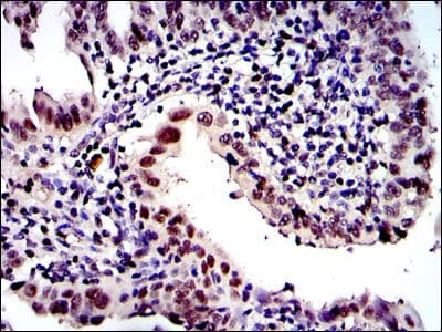 PSMB8 / LMP7 Antibody (clone 1A5)