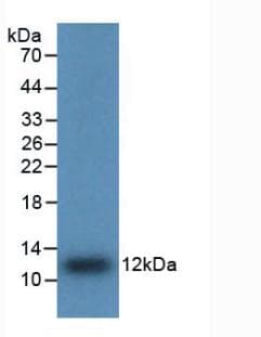 IL8 / Interleukin 8 Antibody (aa28-99)