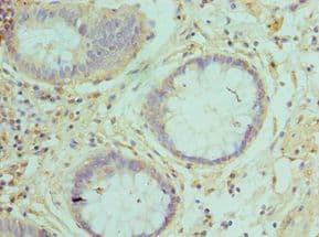 RAB5A / RAB5 Antibody (aa1-215)
