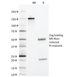 SERPINA1 / Alpha 1 Antitrypsin Antibody (clone AAT/1378)