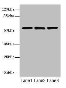 Polyclonal Rabbit anti-Human CPSF3L Antibody (IHC, WB)