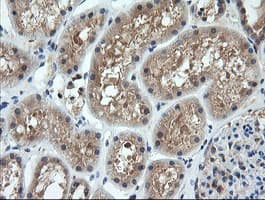Monoclonal Mouse anti-Human CTAG1B / NY-ESO-1 Antibody (clone OTI5H4, IHC, IF, WB)