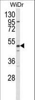 Polyclonal Rabbit anti-Human ALDH5A1 Antibody (IHC, WB)