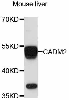 CADM2 Antibody
