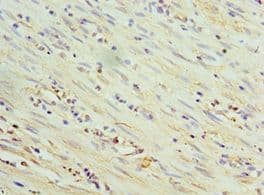 THBS3 / Thrombospondin 3 Antibody (aa787-956)