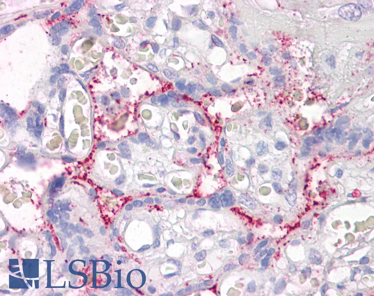 IHC-plus™ Polyclonal Goat anti-Human RAIN / RASIP1 Antibody (aa951-963, IHC)