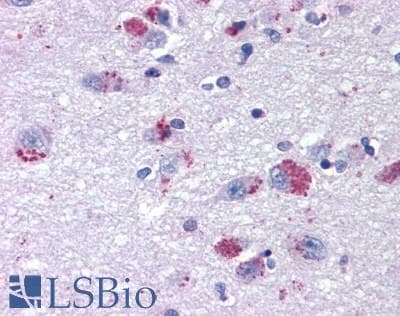 PathPlus™ MRGPRX2 / MRGX2 Antibody (Extracellular Domain)