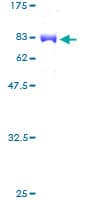 Human MPP1 Protein (Recombinant GST)