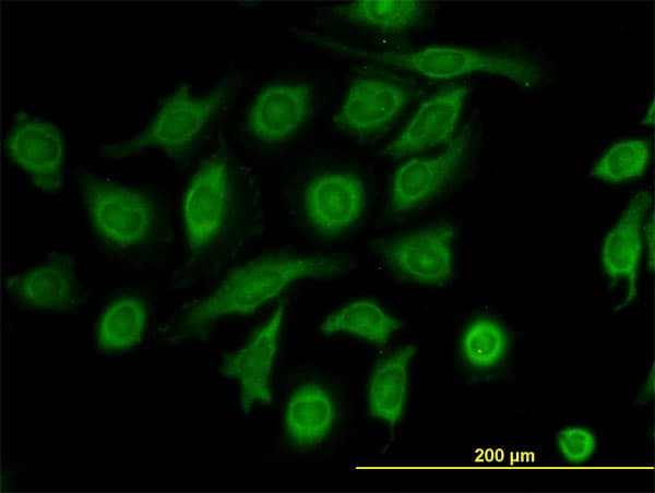 IHC-plus™ TIMP2 Antibody (clone 1C3)