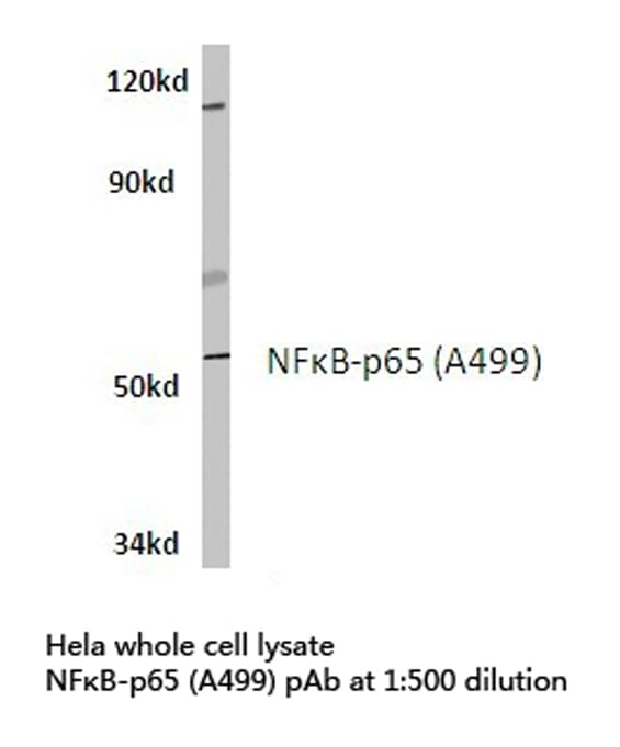 RELA / NFKB p65 Antibody (Ala499)