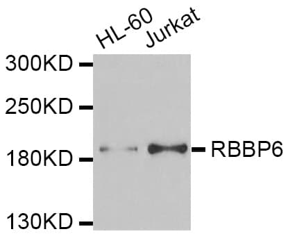 RBBP6 Antibody (aa1-118)