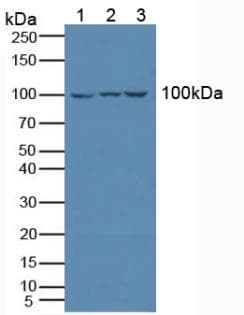 ILT2 / CD85 Antibody (aa223-410)