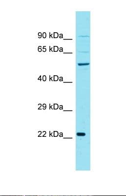 CCNJL Antibody (aa65-113)