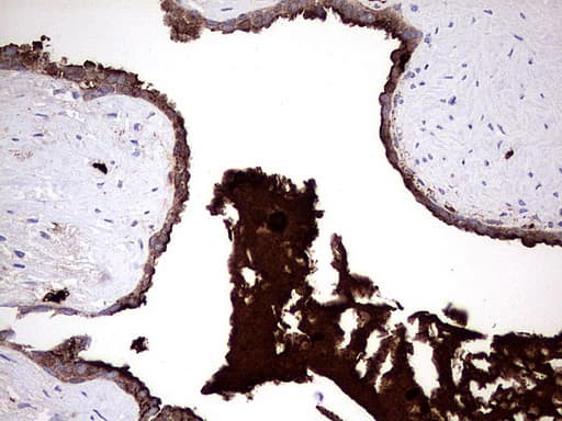 S100A9 / MRP14 Antibody (clone UMAB173)