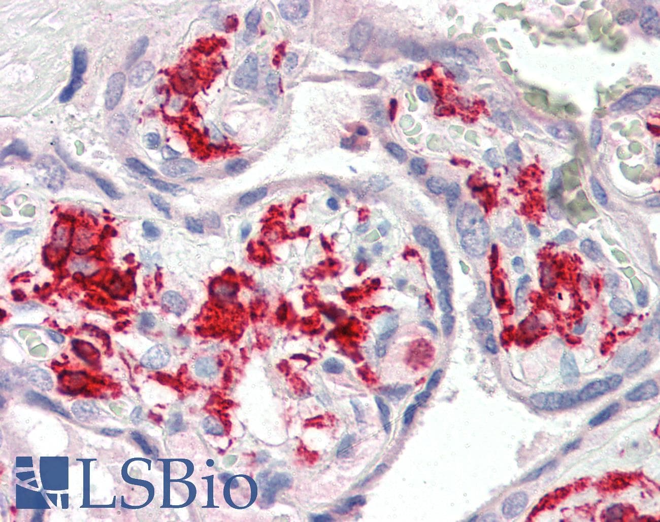 PathPlus™ Polyclonal Goat anti-Human AIF1 / IBA1 Antibody (aa42-56, IHC, WB)
