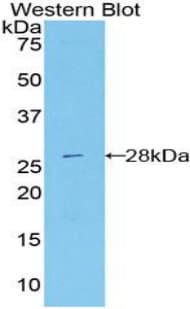 DDX58 / RIG-1 / RIG-I Antibody (aa1-211)