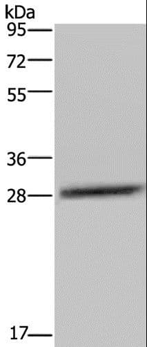 C/EBP Delta / CEBPD Antibody