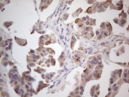Monoclonal Mouse anti-Human RORB / ROR Beta Antibody (clone OTI1G1, aa1-260, IHC, WB)