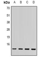 SSNA1 Antibody