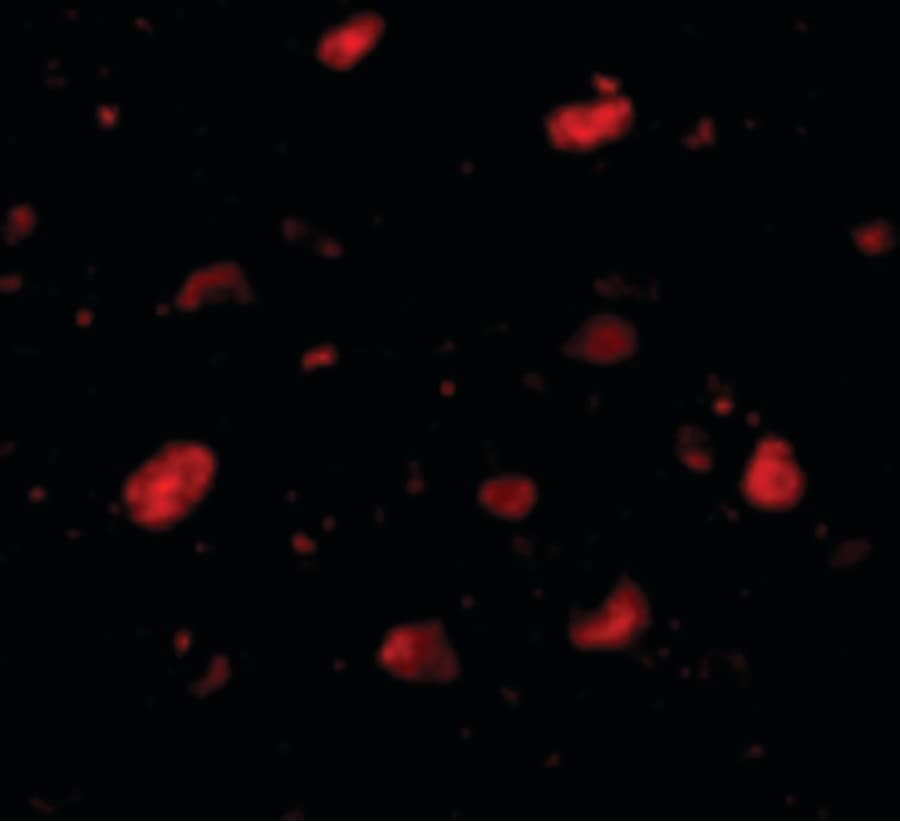 SLITRK5 Antibody